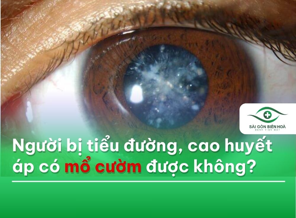 Bị tiểu đường có mổ cườm được không?
