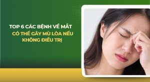 các bệnh về mắt có thể gây mù