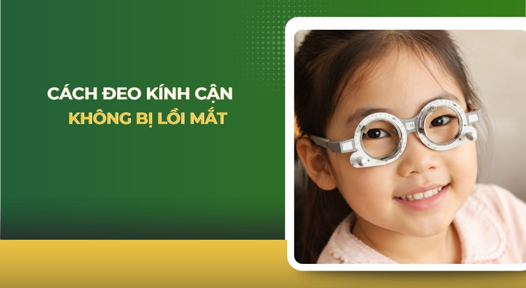 Cách đeo kính cận không bị lồi mắt