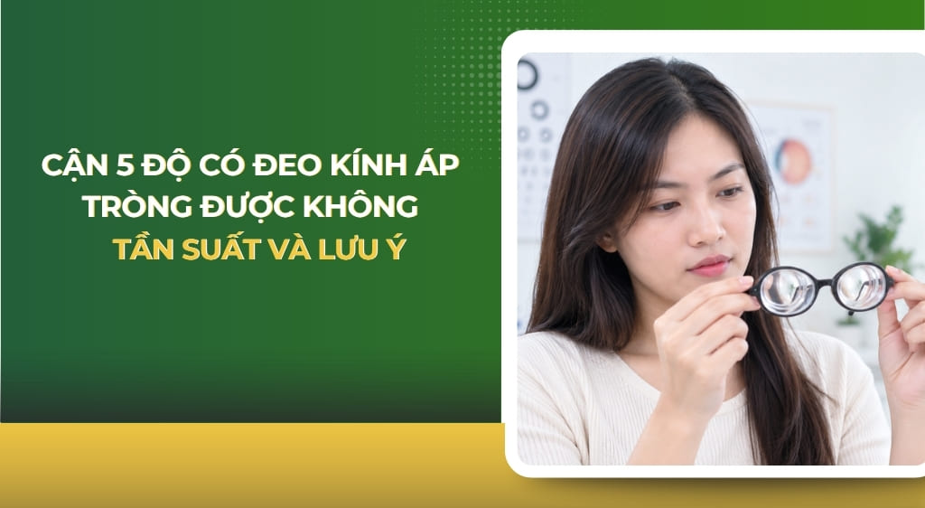 Cận 5 độ có đeo kính áp tròng được không