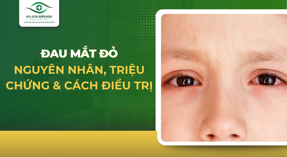 Đau mắt đỏ