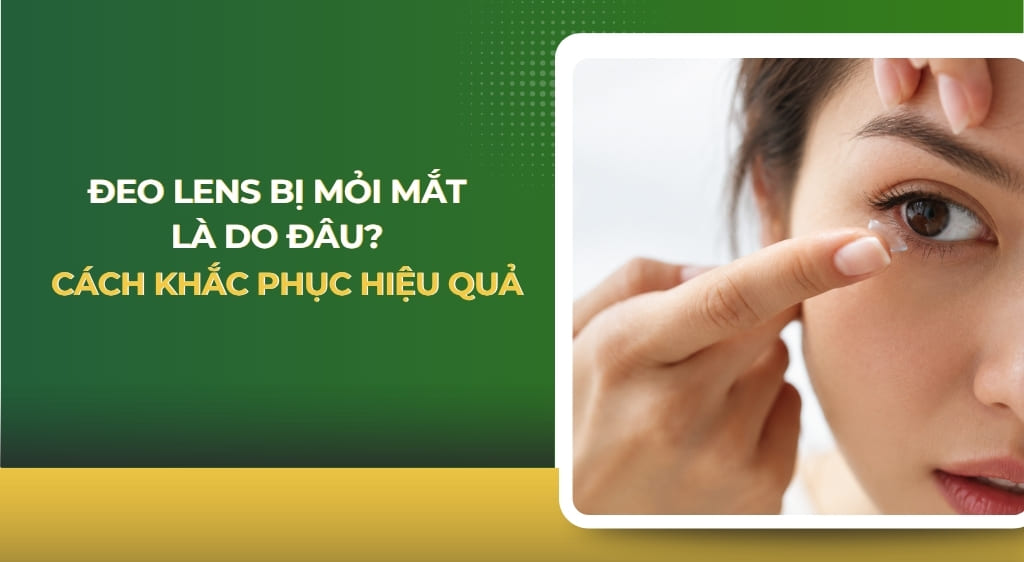 Đeo lens bị mỏi mắt