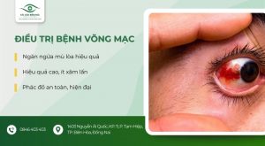 điều trị bệnh võng mạc