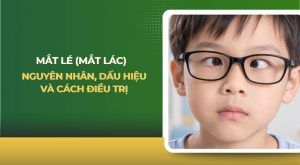 Mắt lé