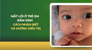 mắt lồi ở trẻ em