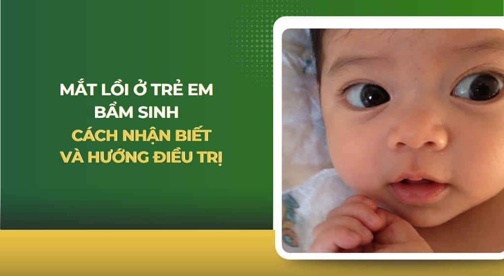 mắt lồi ở trẻ em