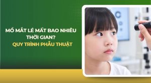 Mổ mắt lé mất bao nhiêu thời gian