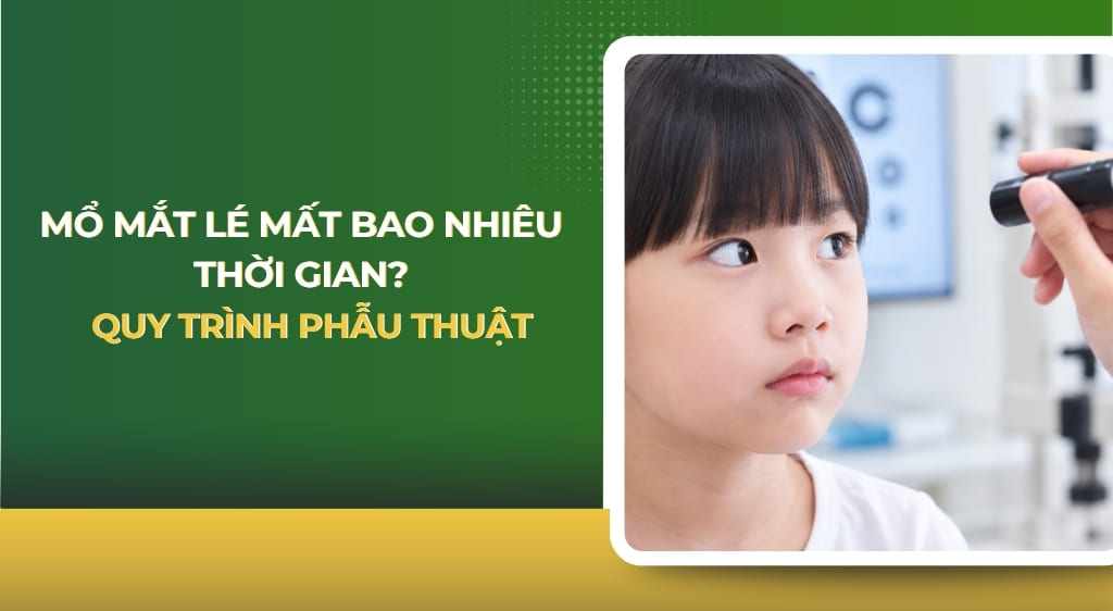 Mổ mắt lé mất bao nhiêu thời gian
