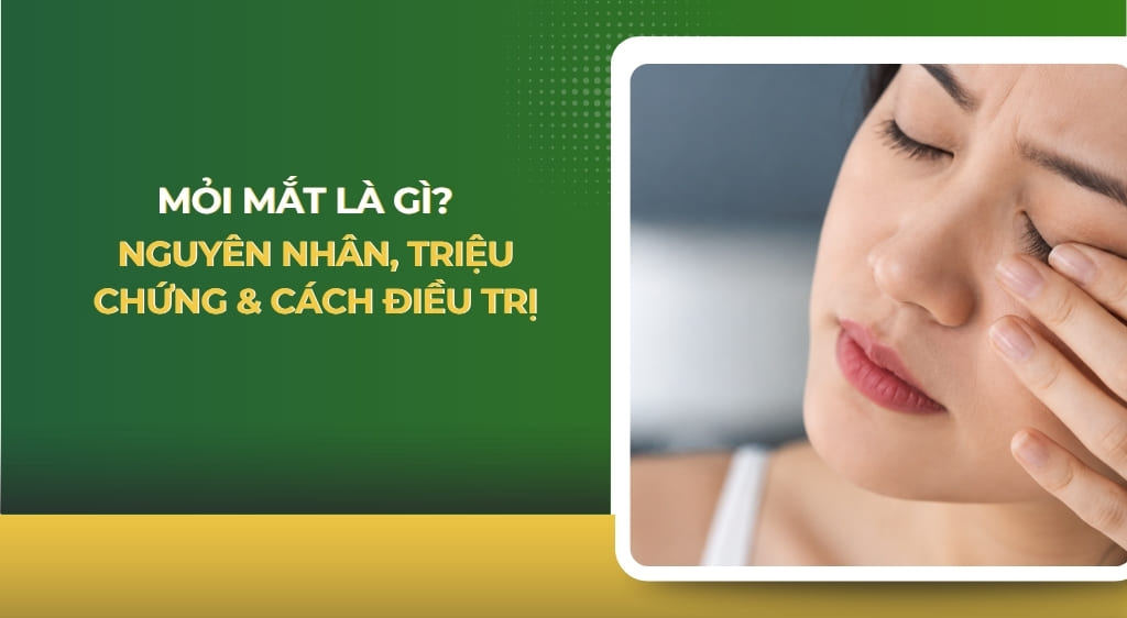 mỏi mắt