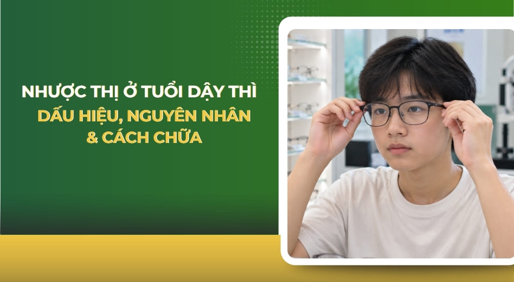 nhược thị ở tuổi dậy thì