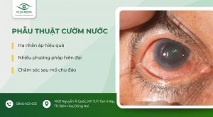 phẫu thuật cườm nước