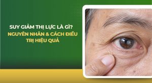suy giảm thị lực