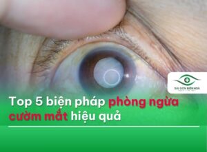 Top 5 biện pháp phòng ngừa cườm mắt
