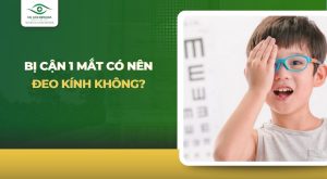 Bị cận 1 mắt có nên đeo kính không? Cần lưu ý gì?