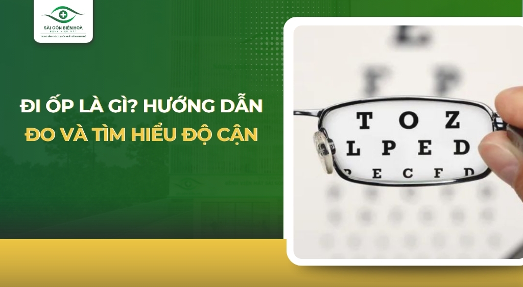Đi ốp là gì?