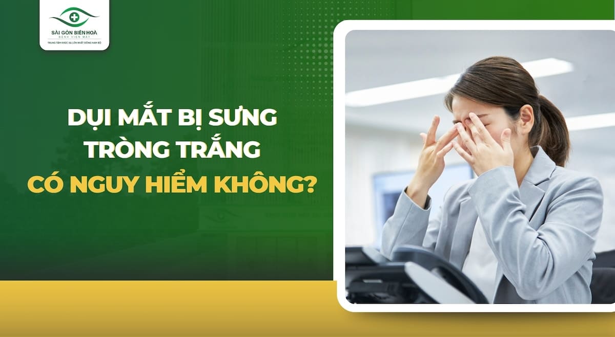 Dụi mắt bị đỏ mắt