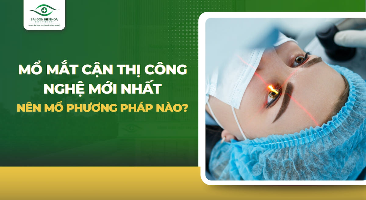 Mổ mắt cận thị công nghệ mới nhất
