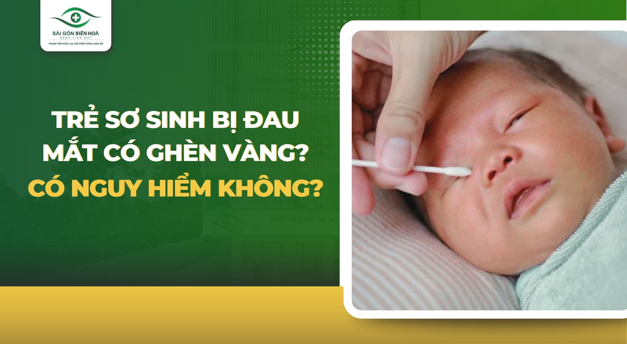 Trẻ sơ sinh bị đau mắt có ghèn vàng