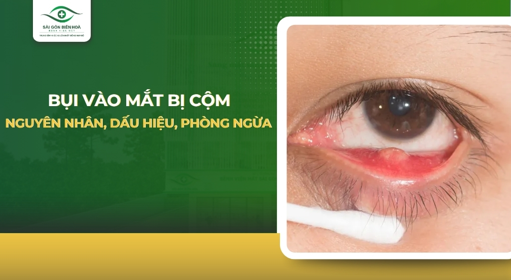 Bụi vào mắt bị cộm
