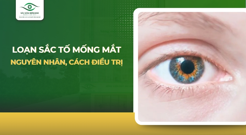 Loạn sắc tố mống mắt