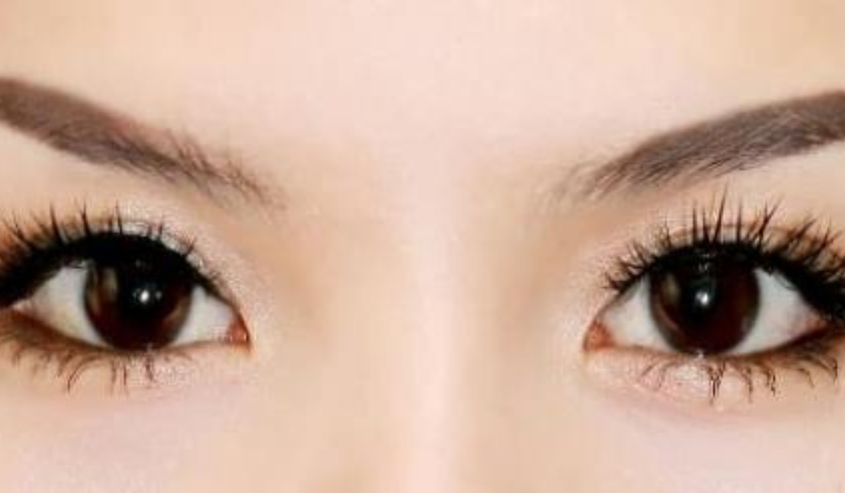 Mắt tròng đen nhiều hơn, hãy đi khám nếu có dấu hiệu bất thường