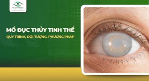 Phẫu thuật đục thủy tinh thể