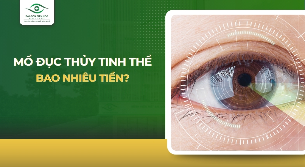 Mổ đục thủy tinh thể bao nhiêu tiền