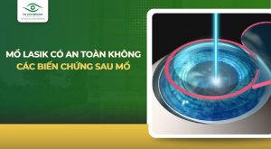 Mổ LASIK có an toàn không? Các biến chứng có thể gặp sau mổ là gì?