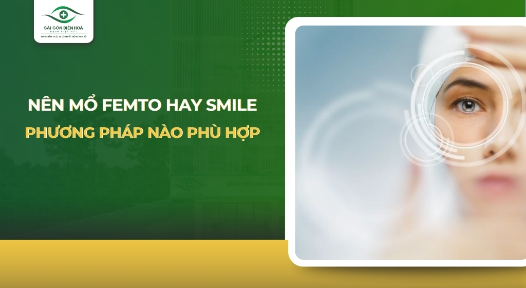 Nên mổ Femto hay Smile