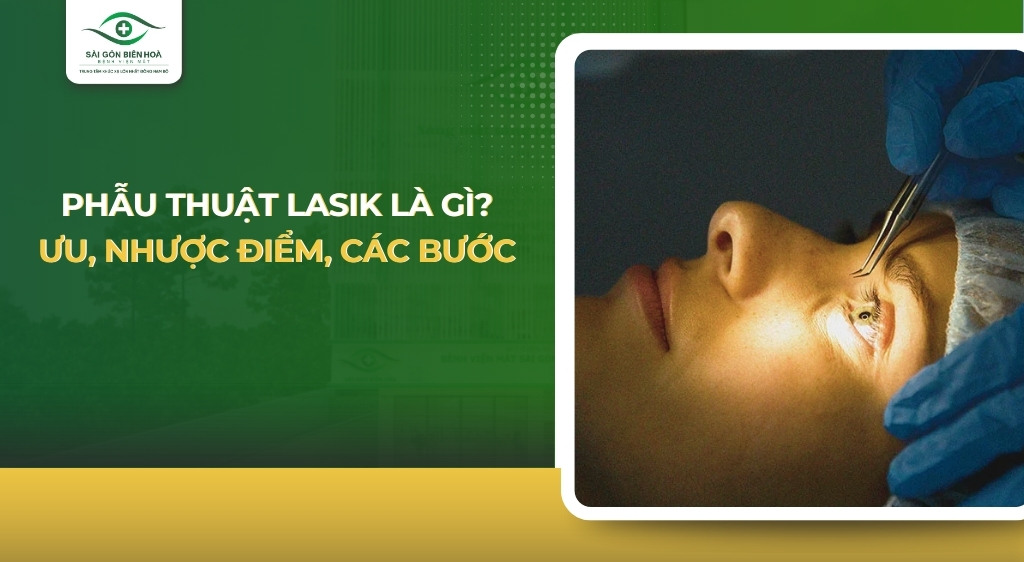 Phẫu thuật LASIK