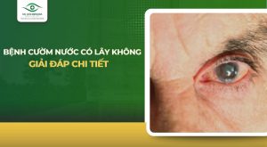 Bệnh cườm nước có lây không