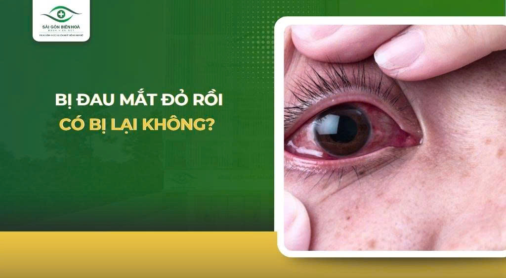 Bị đau mắt đỏ rồi có bị lại không
