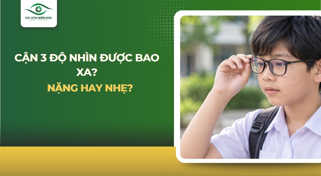 cận 3 độ nhìn được bao xa