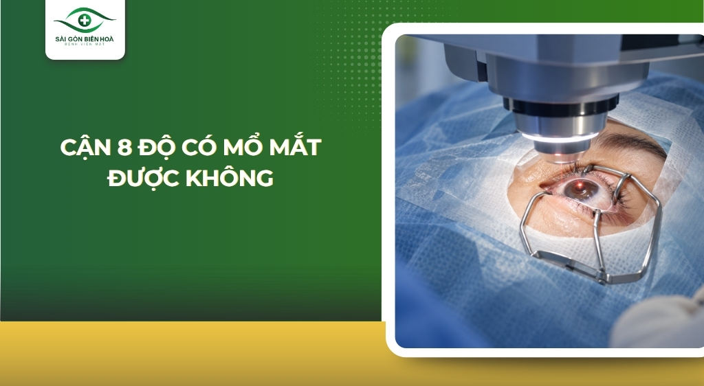 Cận 8 độ có mổ mắt được không