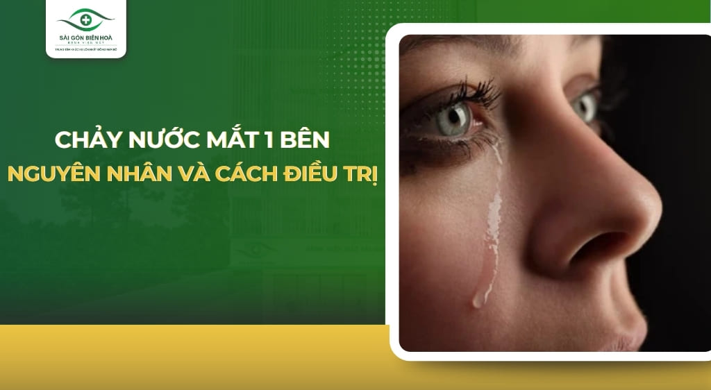 chảy nước mắt 1 bên