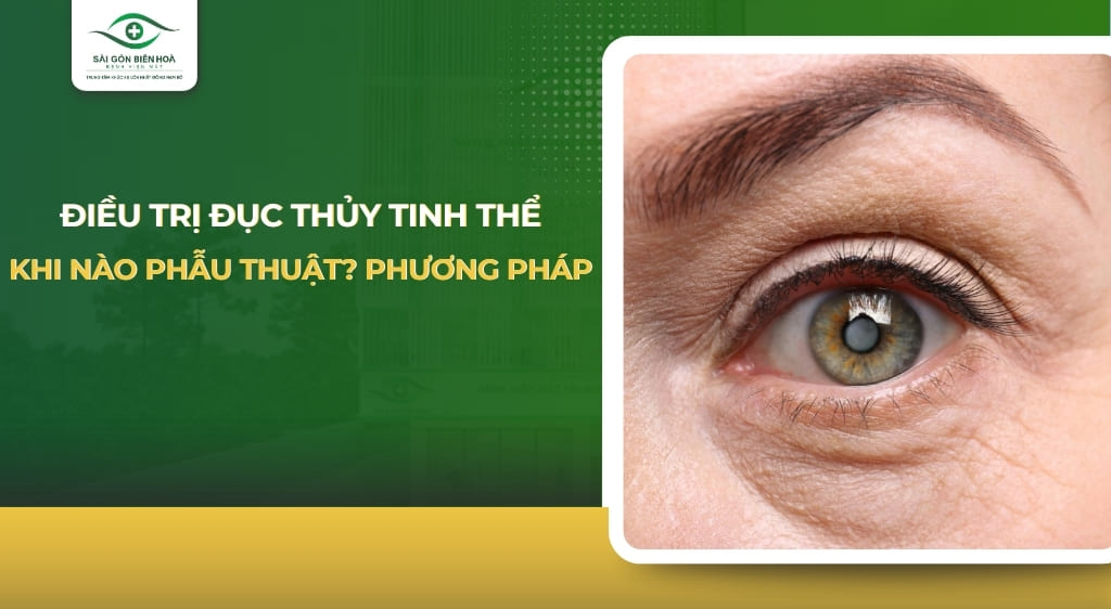 Điều trị đục thủy tinh thể