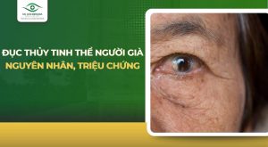 đục thủy tinh thể người già