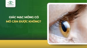 giác mạc mỏng