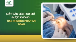 Mắt cận lệch có mổ được không?