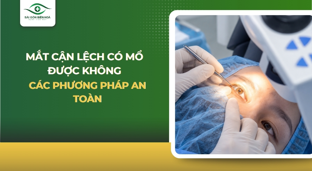 Mắt cận lệch có mổ được không?