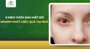 mẹo chữa đau mắt đỏ nhanh nhất