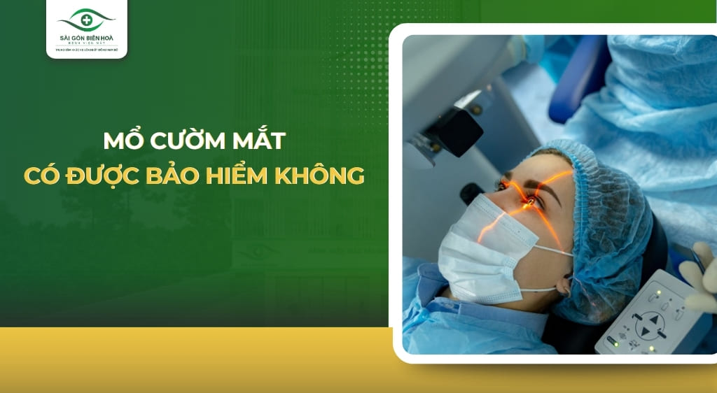 mổ cườm mắt có được bảo hiểm không