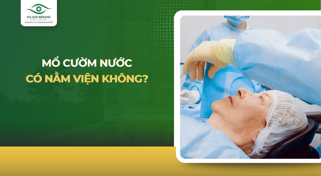 Mổ cườm mắt có nằm viện không