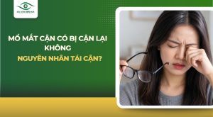 Mổ mắt cận có bị tái cận lại không