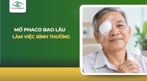Mổ Phaco bao lâu làm việc bình thường