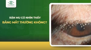rận mu có nhìn thấy bằng mắt thường không