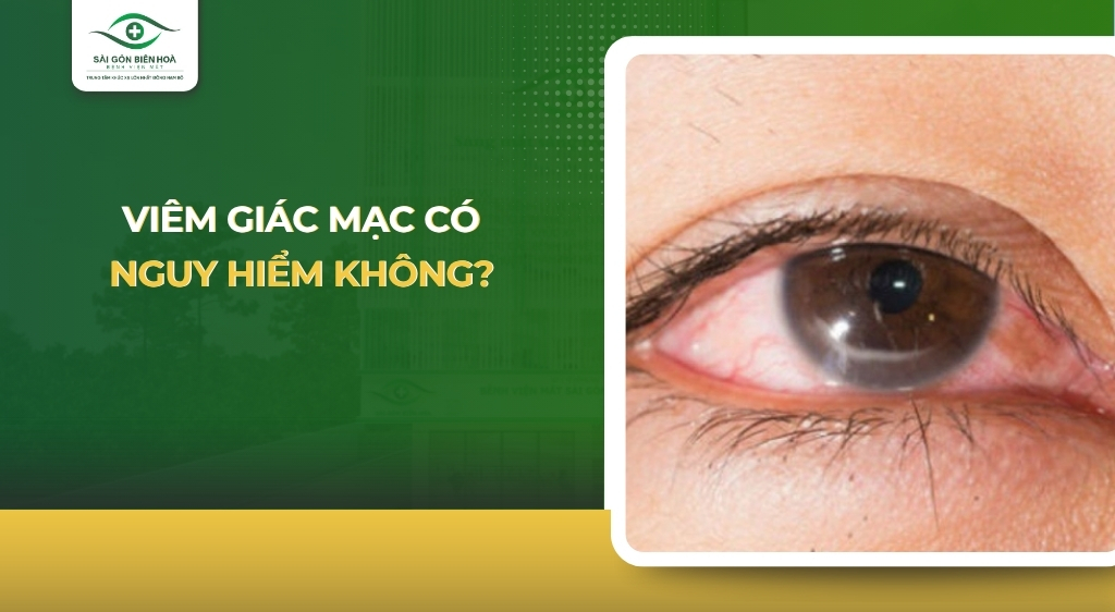 Viêm giác mạc có nguy hiểm không