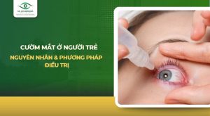 Cườm mắt ở người trẻ
