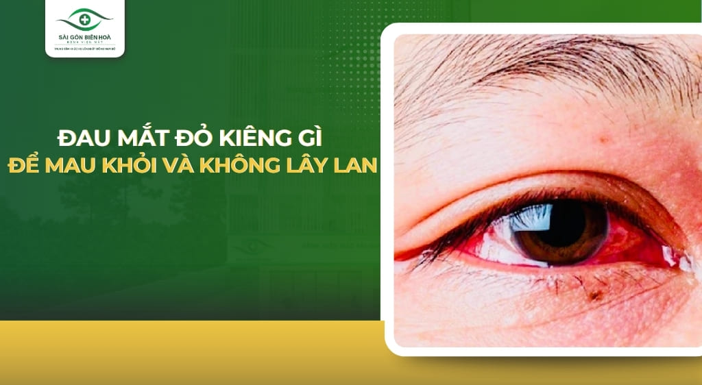 đau mắt đỏ kiêng gì