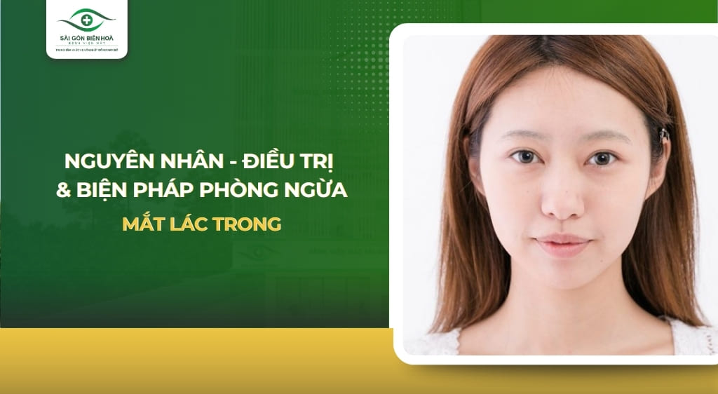 Mắt lác trong